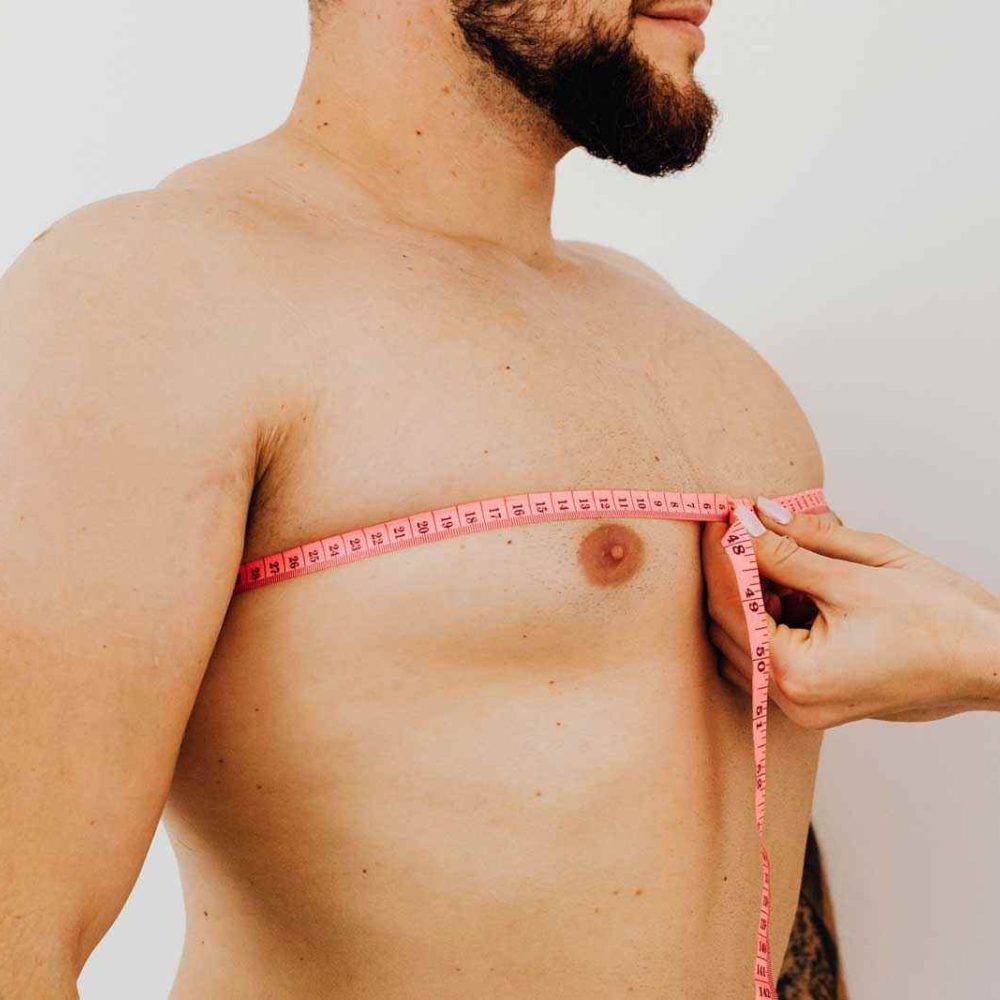 Gynecomastia consultation