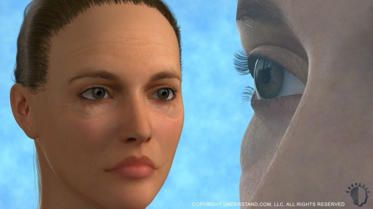 Blepharoplasty Adelaide eyelid surgery video