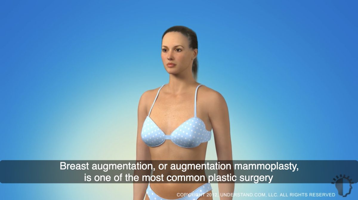 breast augmentation adelaide mammoplasty plastic surgery video