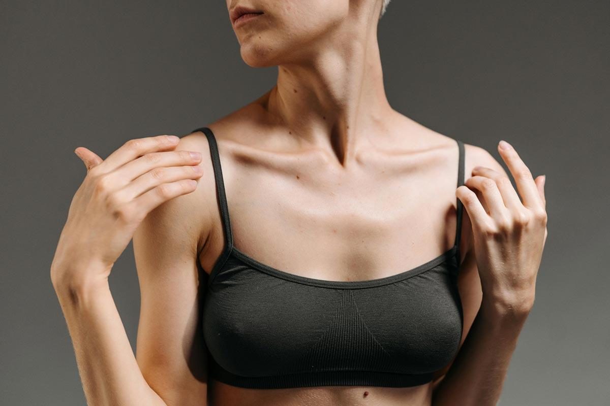 Breast reduction surgery will require scar management